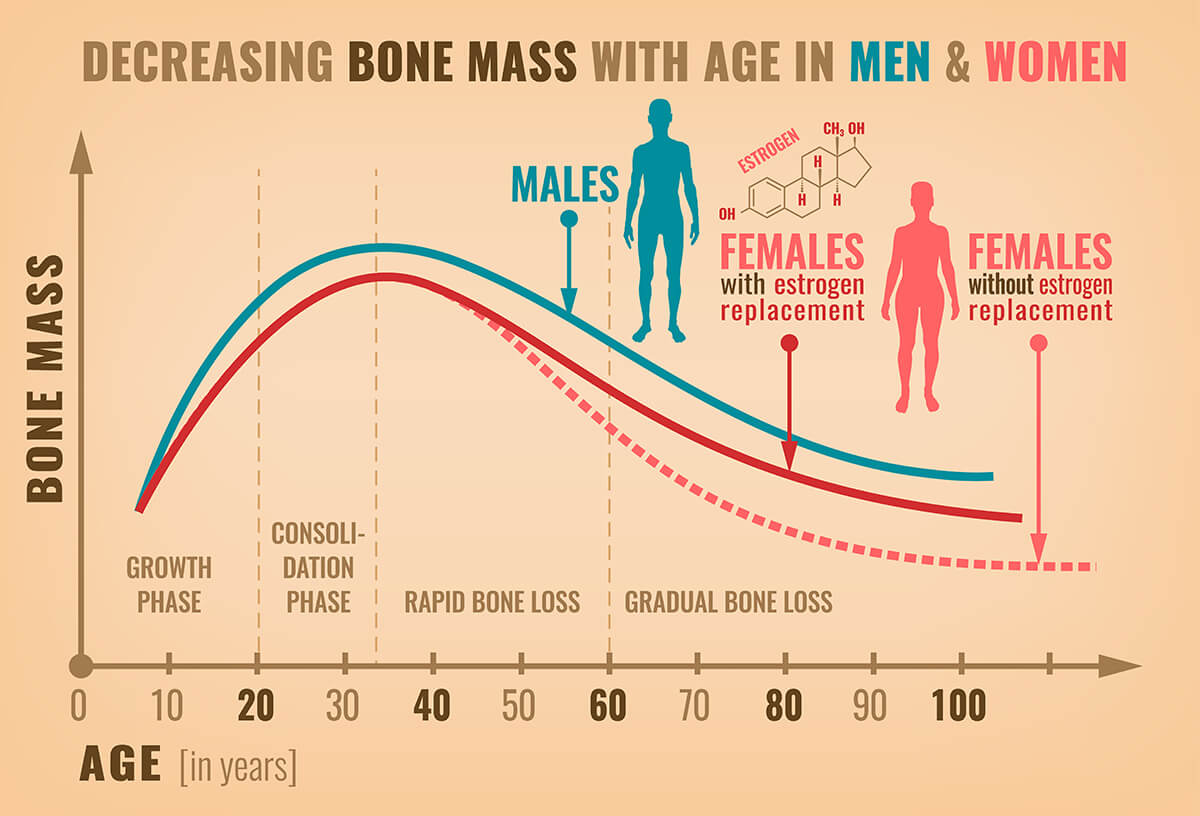 A chart of declining bone mass as we age