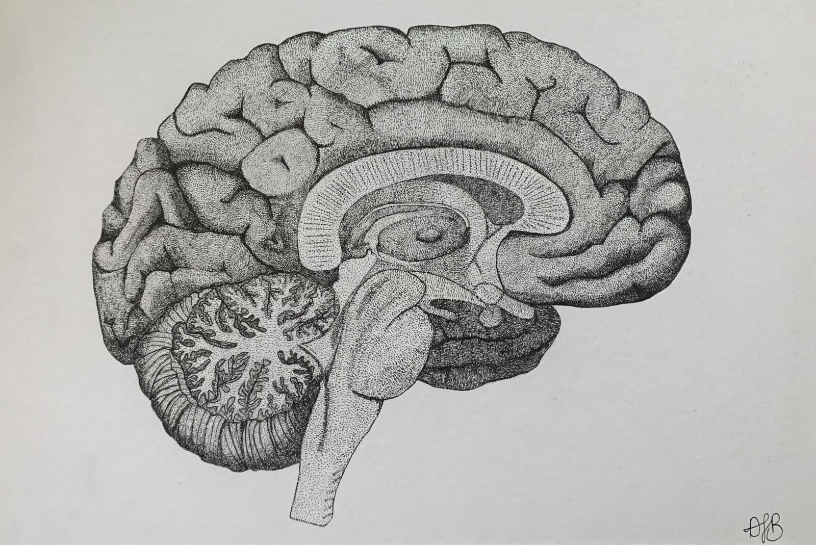 citicoline
